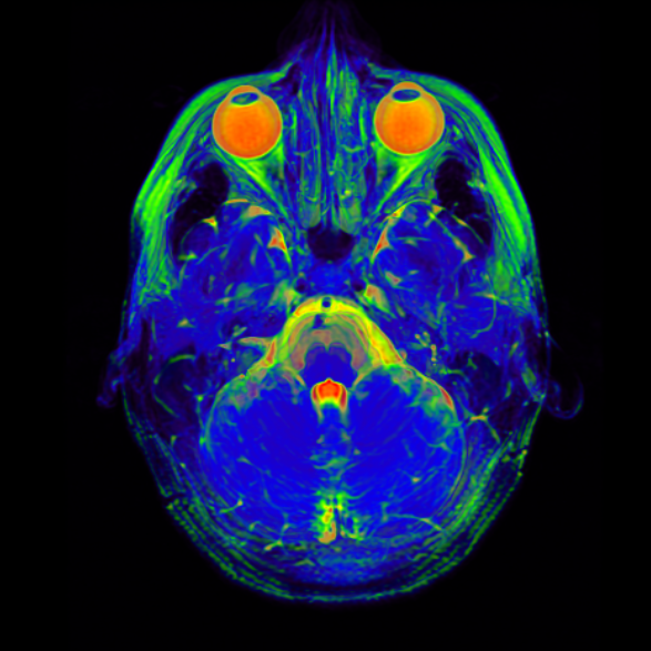 Your Brain, the Computer